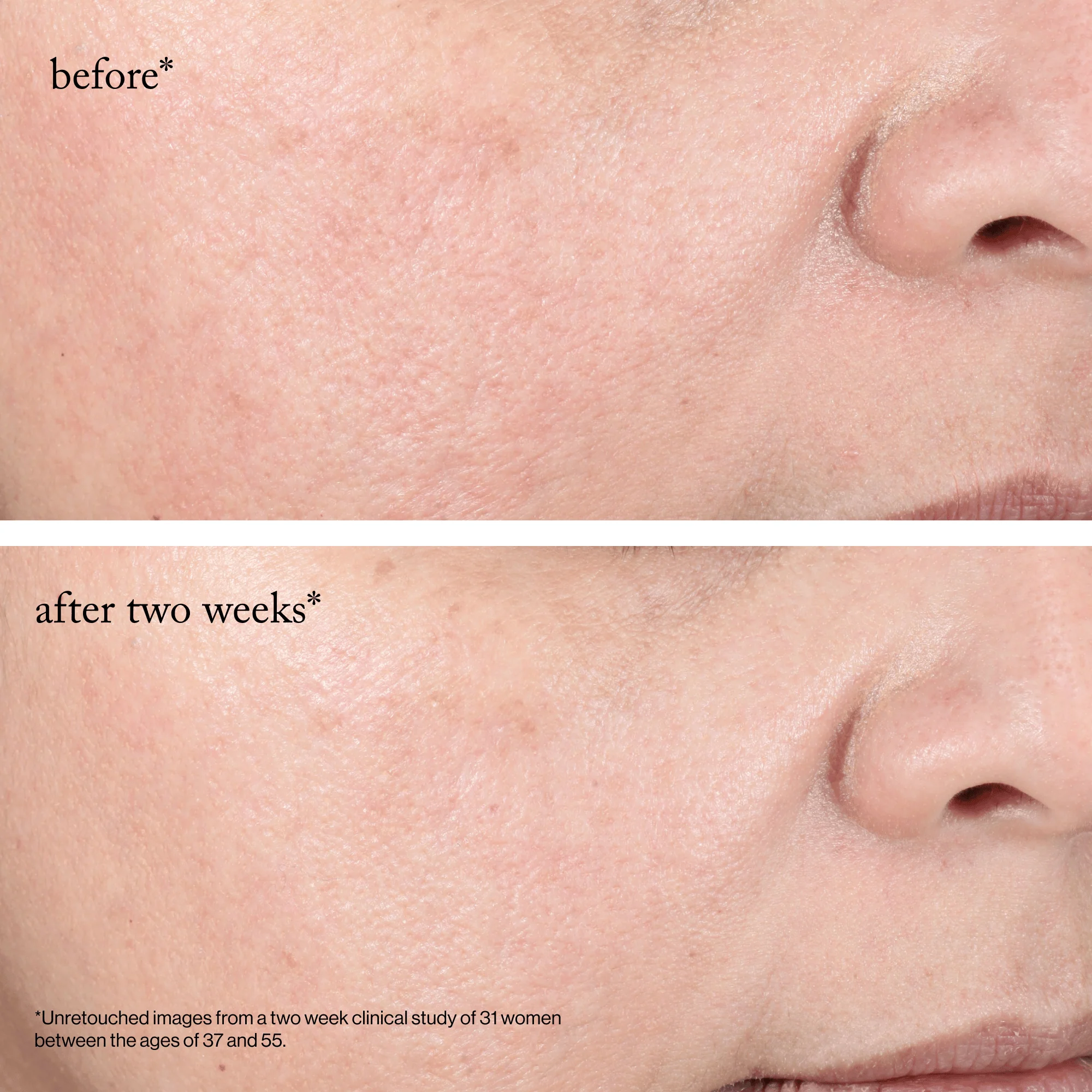 goop beauty 15% Glycolic Acid Overnight Glow Peel - Image 7