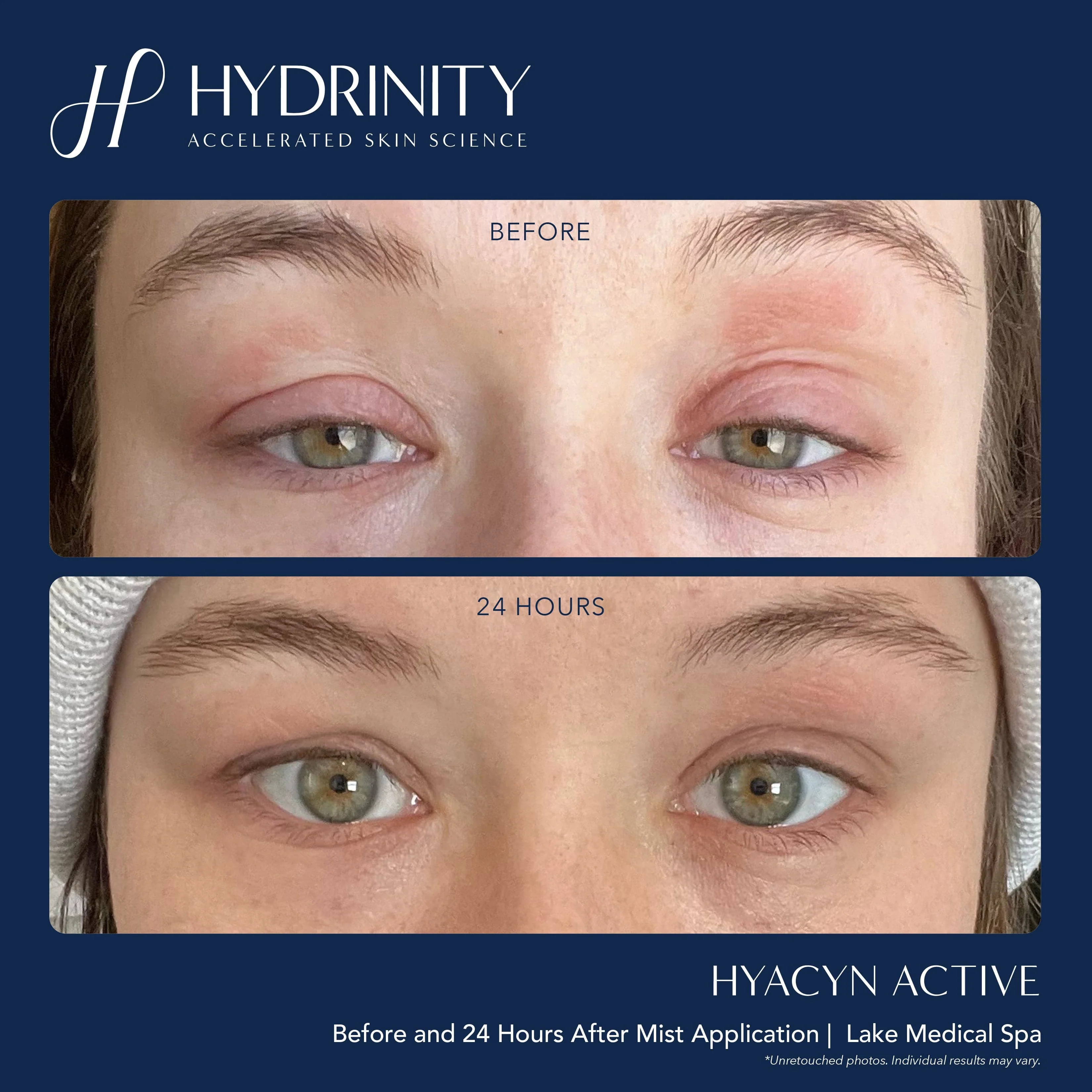 Hydrinity Hyacyn Active Purifying Mist - Image 2
