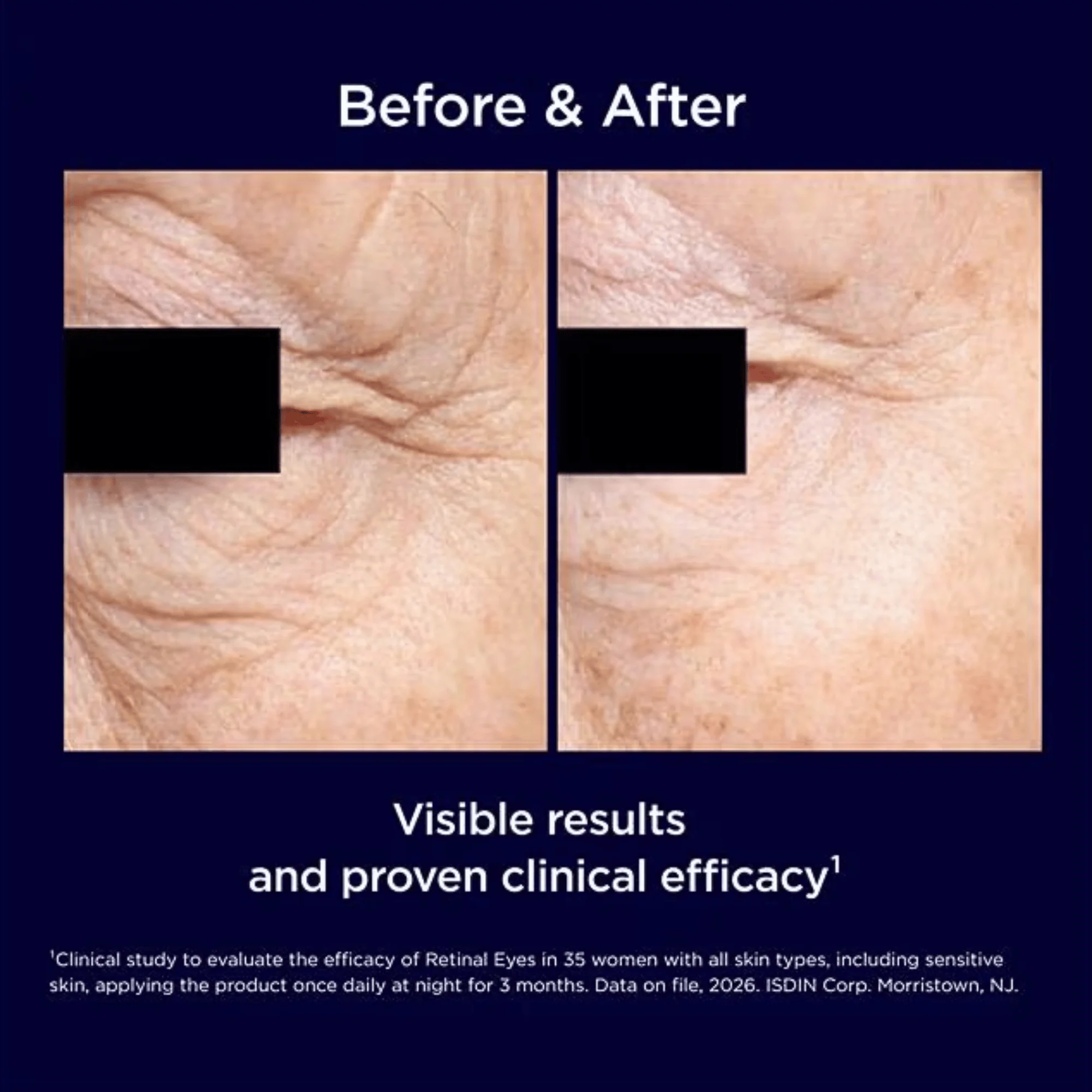 ISDIN Isdinceutics Retinal Eyes Eye Serum - Image 6