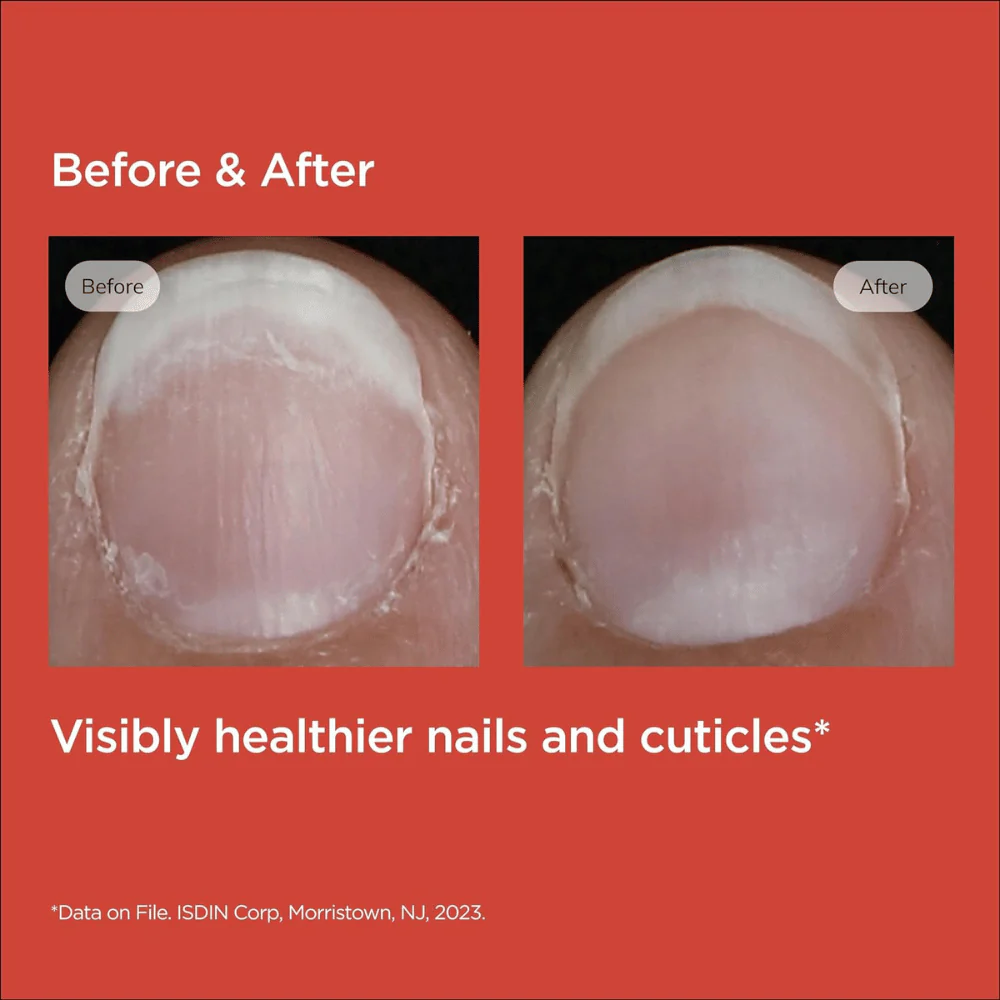 ISDIN Si-Nails Nail Strengthener - Image 4