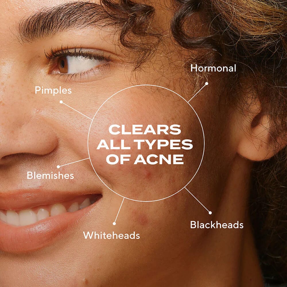 Murad Biome-Balancing Clear & Prevent Acne Treatment Serum - Image 3