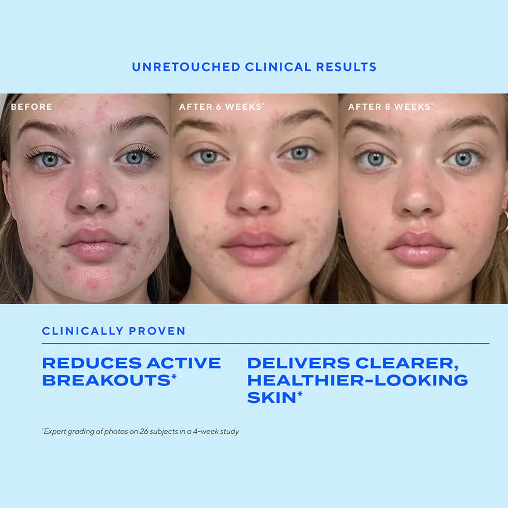 Murad Biome-Balancing Clear & Prevent Acne Treatment Serum - Image 5