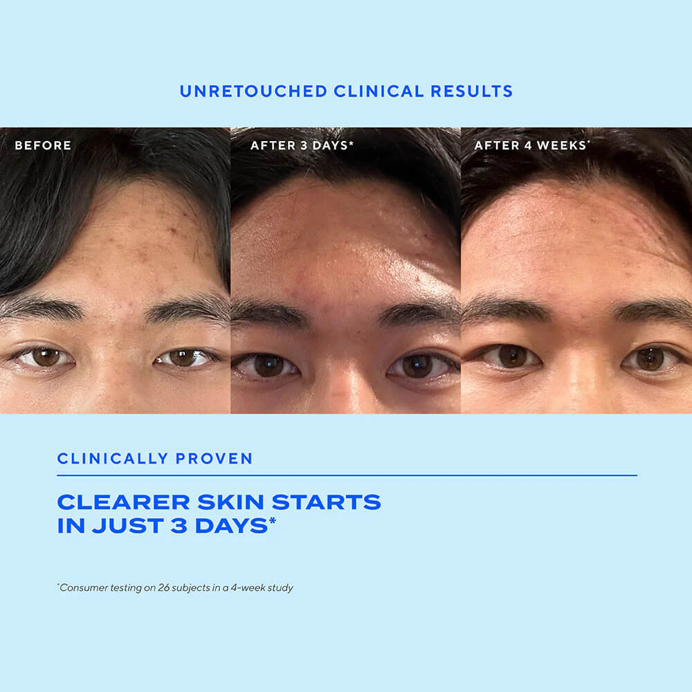 Murad Biome-Balancing Clear & Prevent Acne Treatment Serum - Image 8