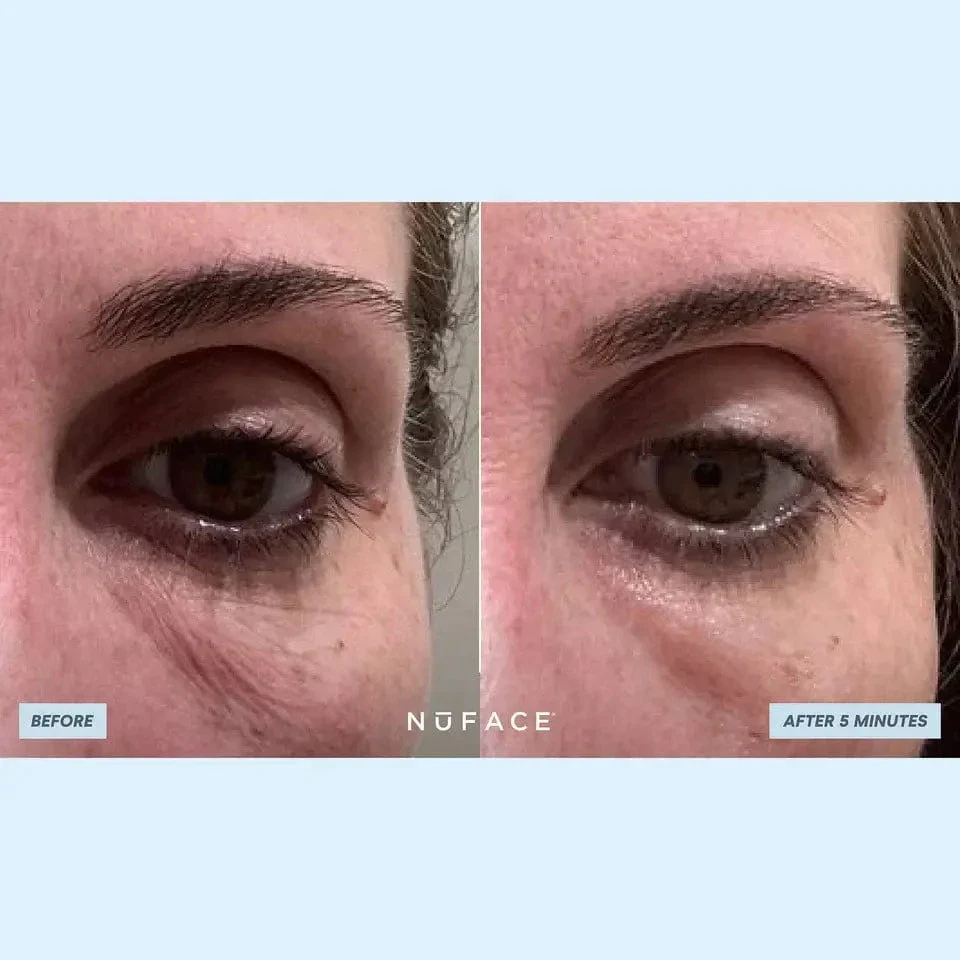NuFACE IonPlex Hydra-Gel Power Patches - Image 8
