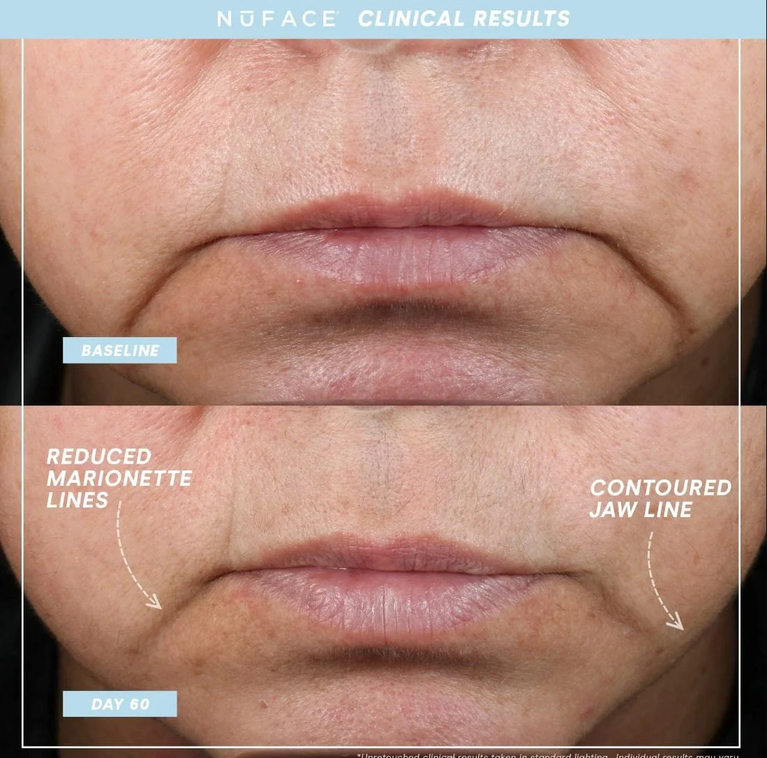 NuFACE MINI+ Starter Kit in Sandy Rose - Image 6