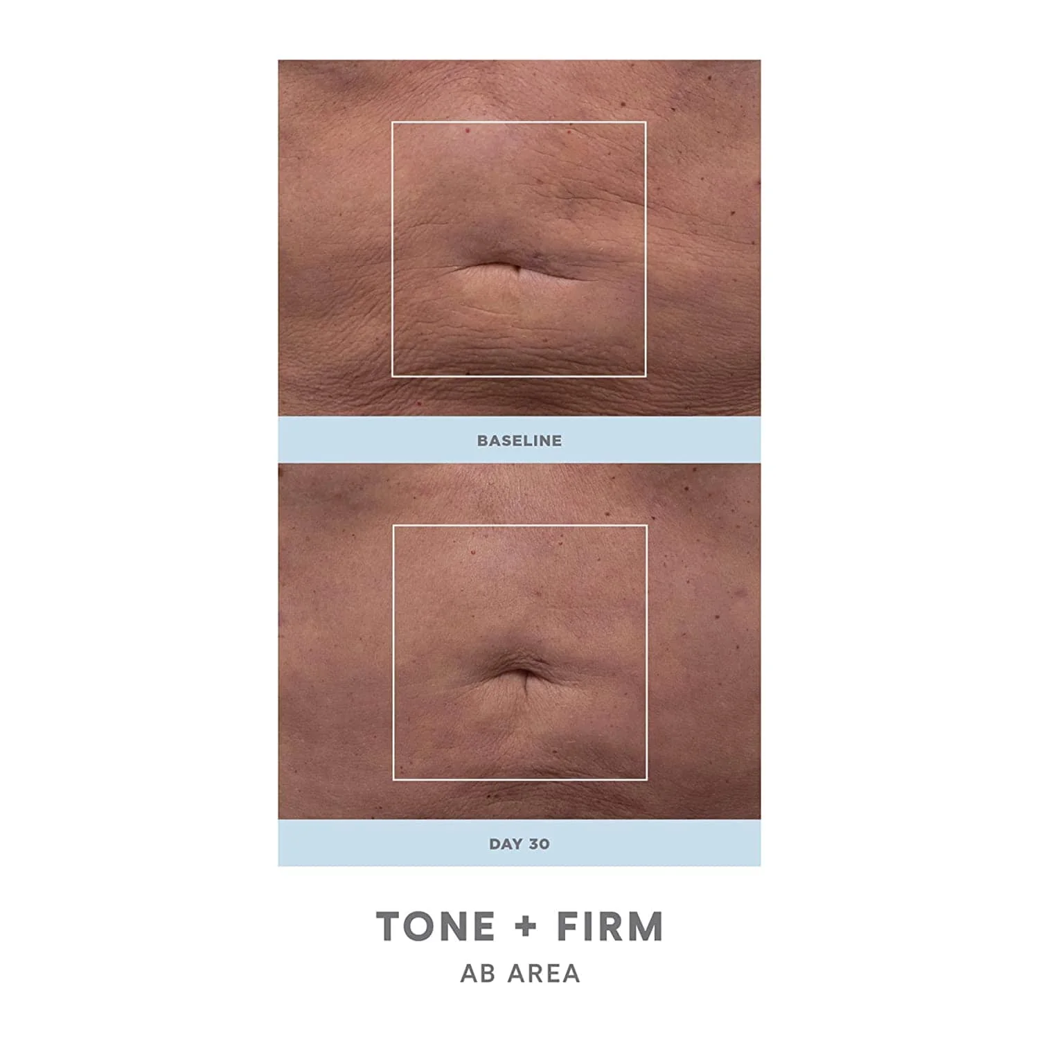 NuFACE NuBODY Toning and Firming Kit - Image 3