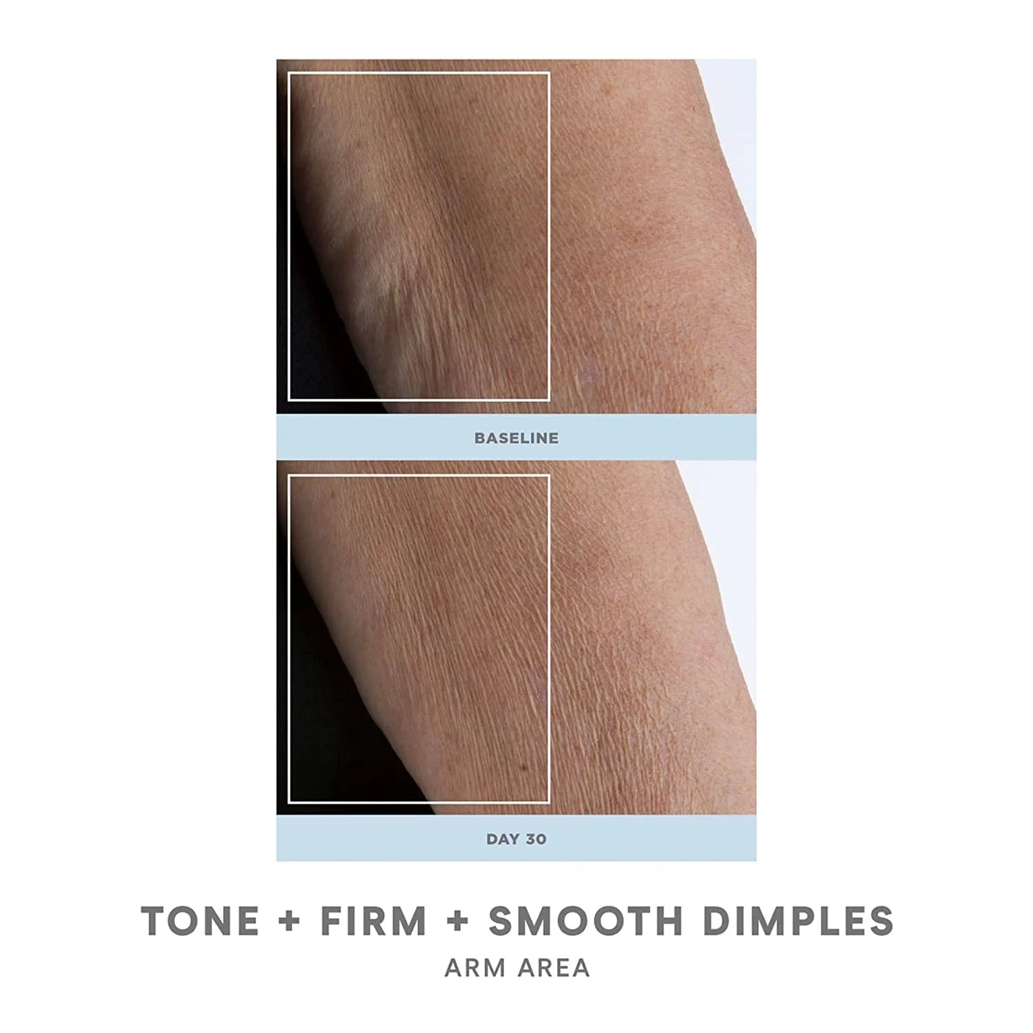 NuFACE NuBODY Toning and Firming Kit - Image 4