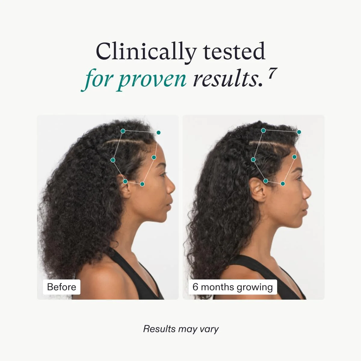 Nutrafol Women's Vegan Hair Growth Nutraceutical - Image 5