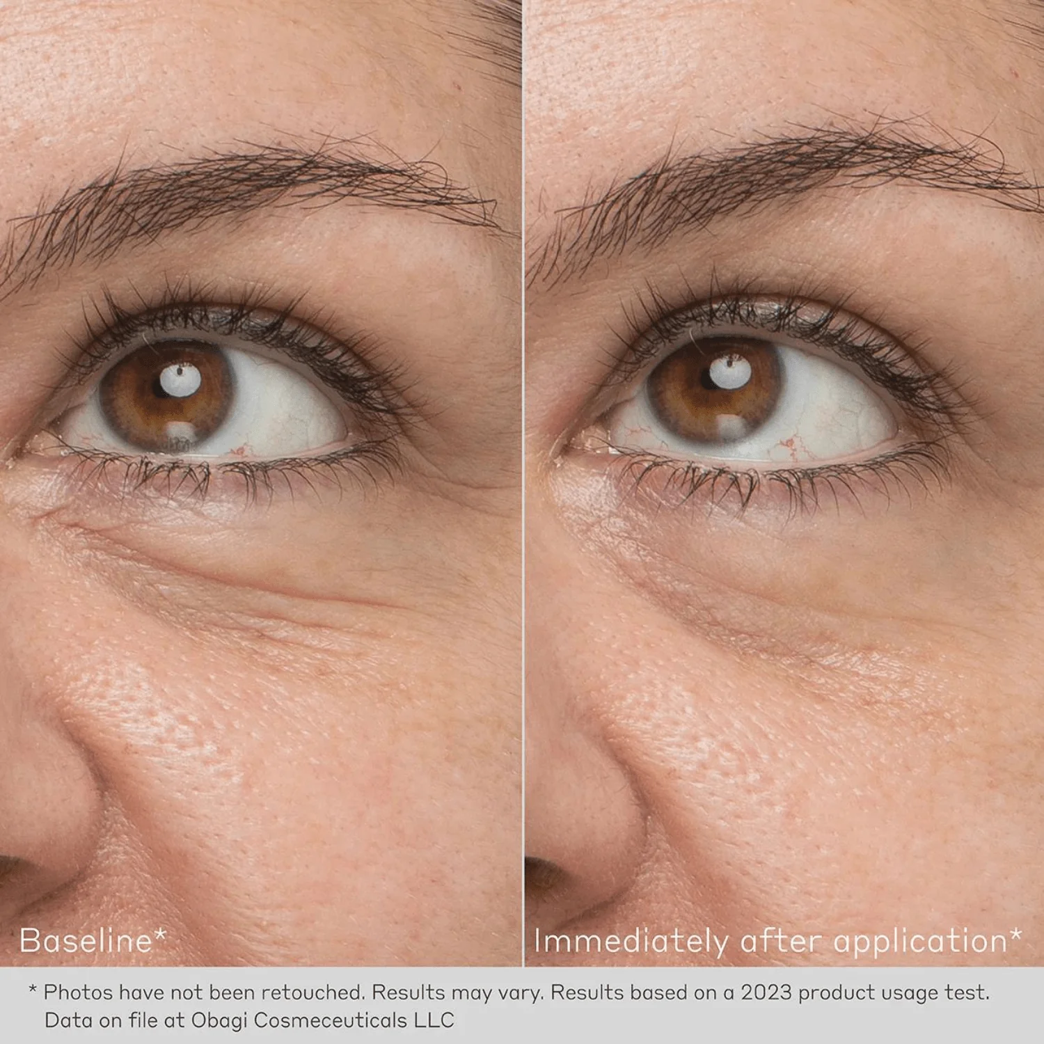 Obagi Daily Hydro-Drops Rejuvenating Eye Gel Cream - Image 6