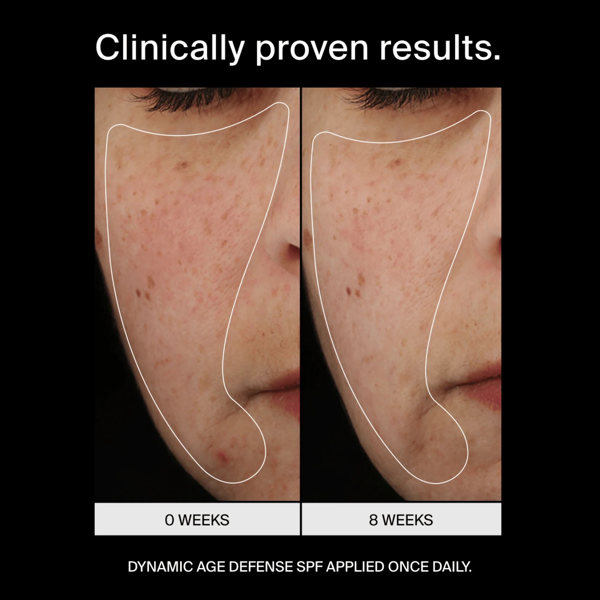 Pavise Dynamic Age Defense SPF 30 Refill Capsule - Image 5
