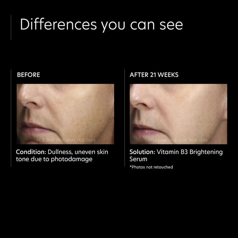PCA Skin Vitamin B3 Brightening Serum - Image 5