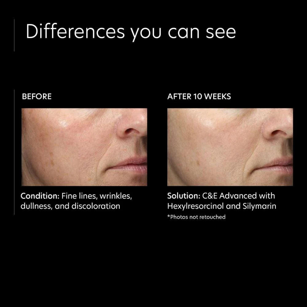 PCA Skin C&E Advanced - Image 6