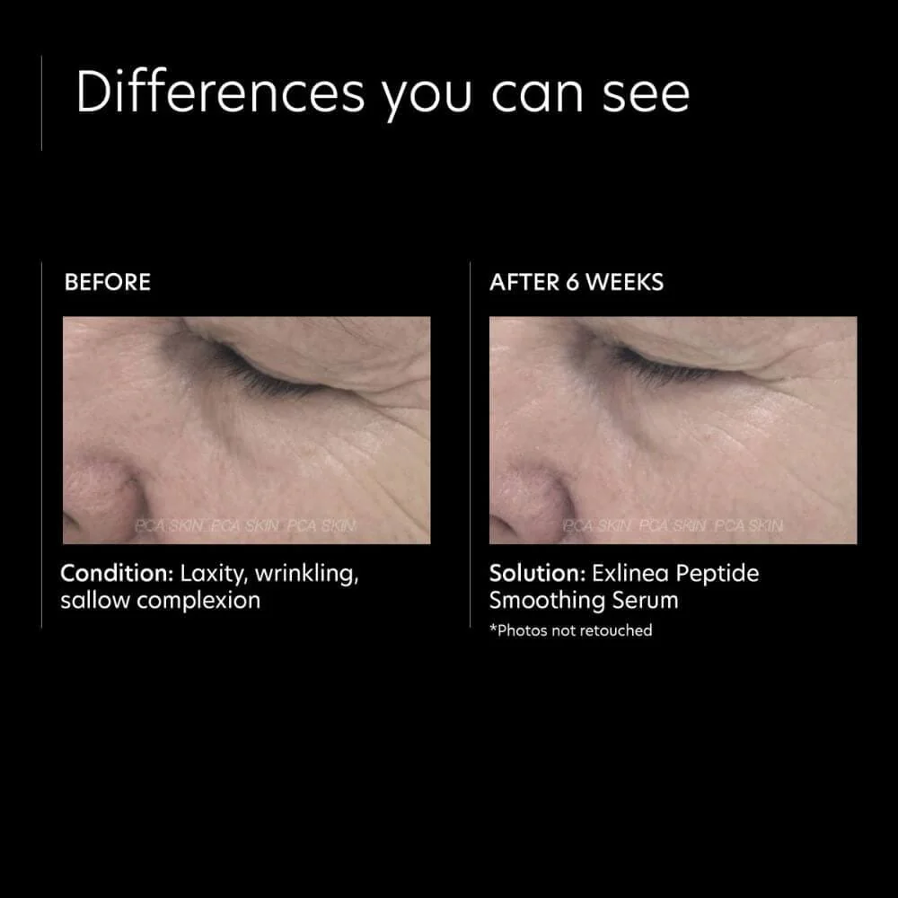 PCA Skin ExLinea Peptide Smoothing Serum - Image 6