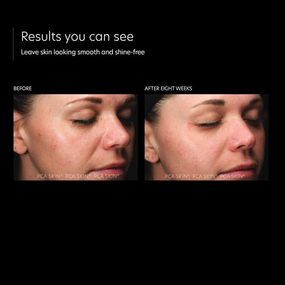 PCA Skin HydraMatte - Image 5