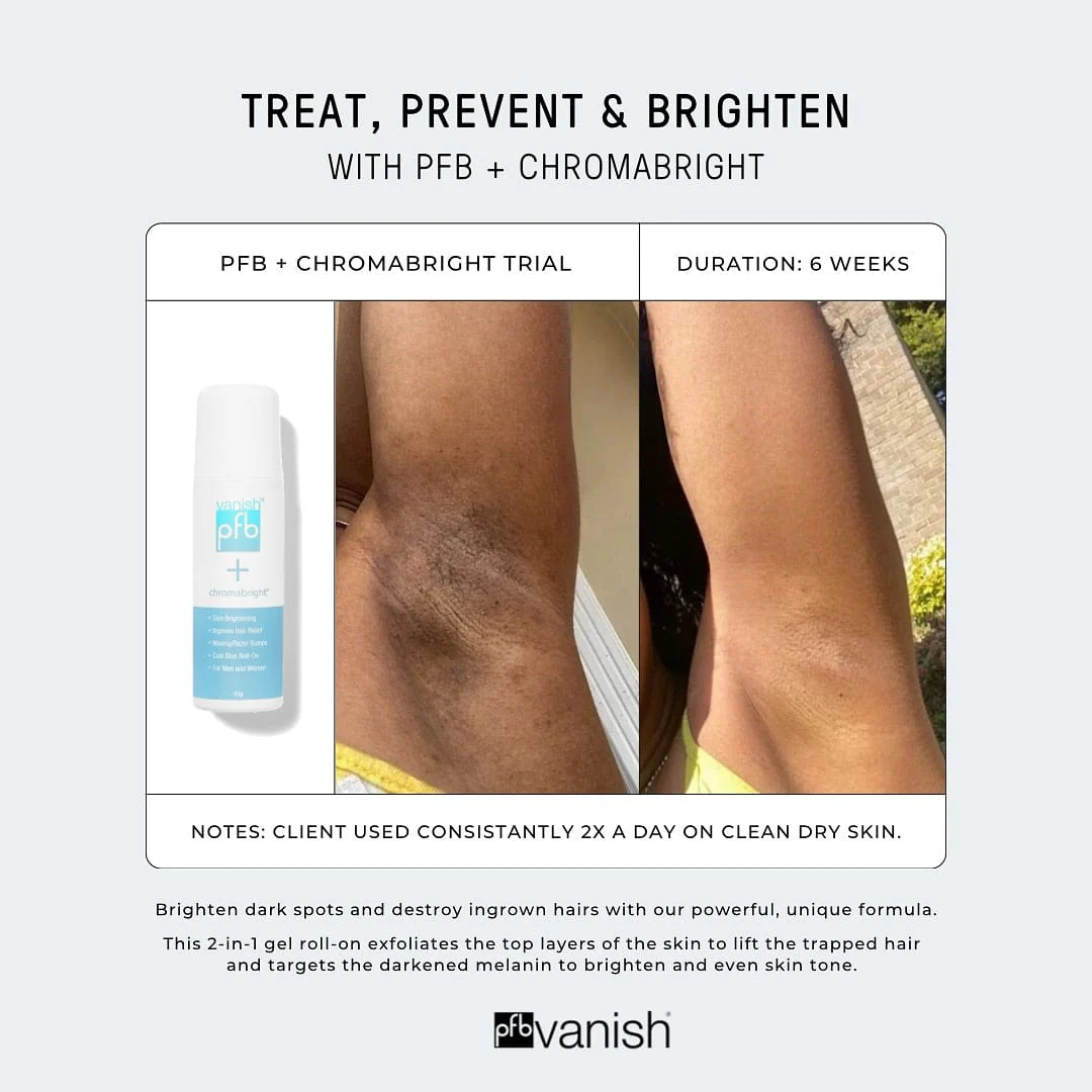 PFB Vanish + Chromabright Skin Lightener & Bump Fighter - Image 3