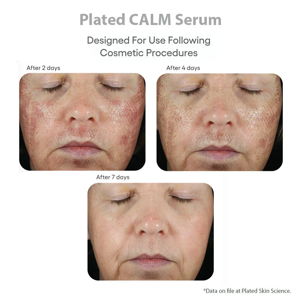 Plated Skin Science CALM Post-Procedure Serum - Image 4