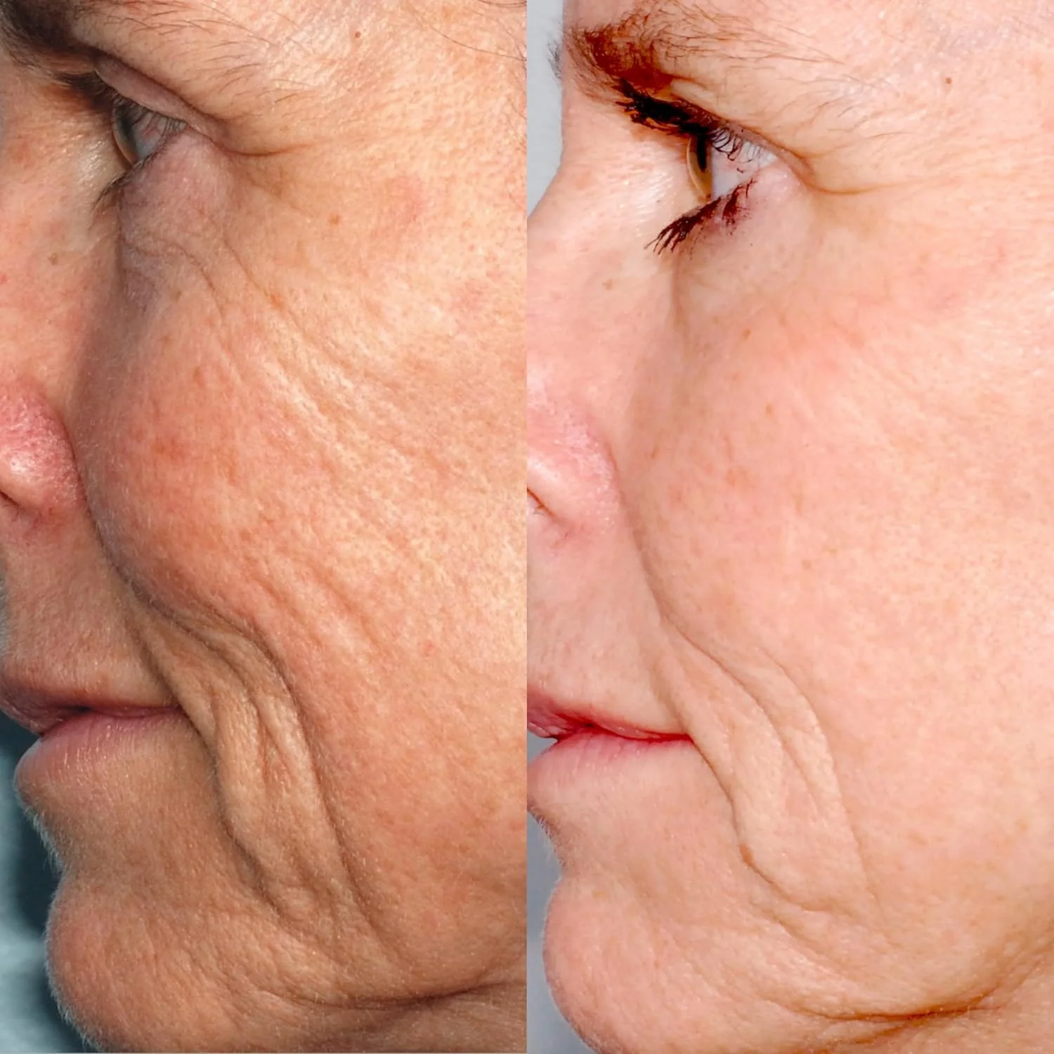 PMD Personal Microderm Classic - Image 10