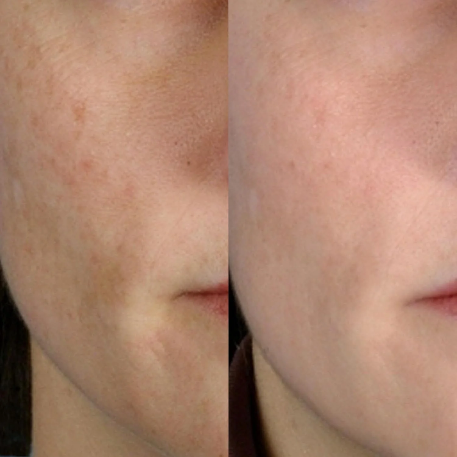 PMD Personal Microderm Classic - Image 9