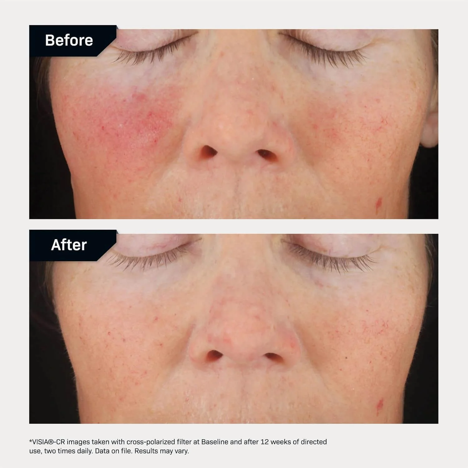 Revision Skincare C+ Correcting Complex 30% - Image 10
