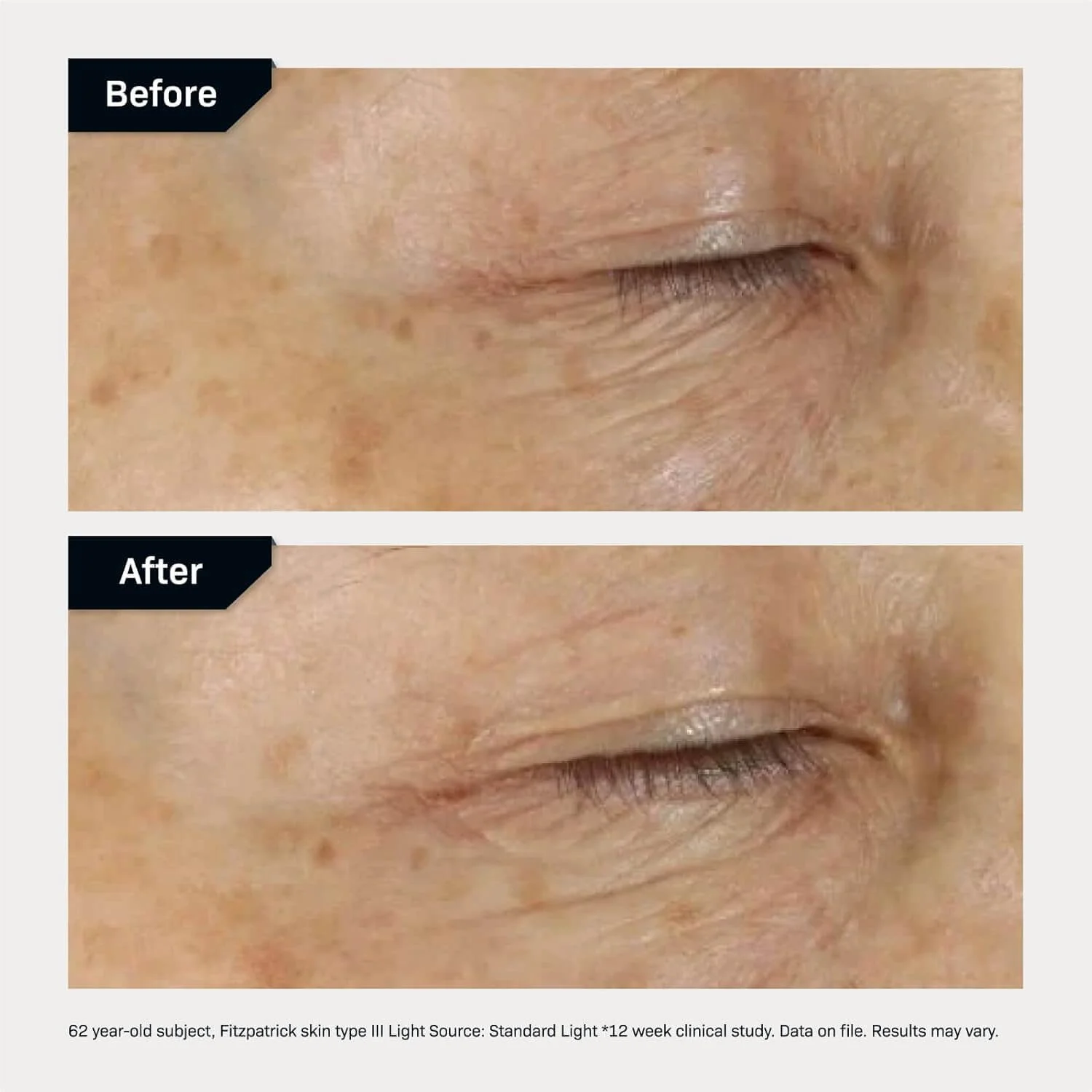 Revision Skincare D.E.J. Eye Cream - Image 5