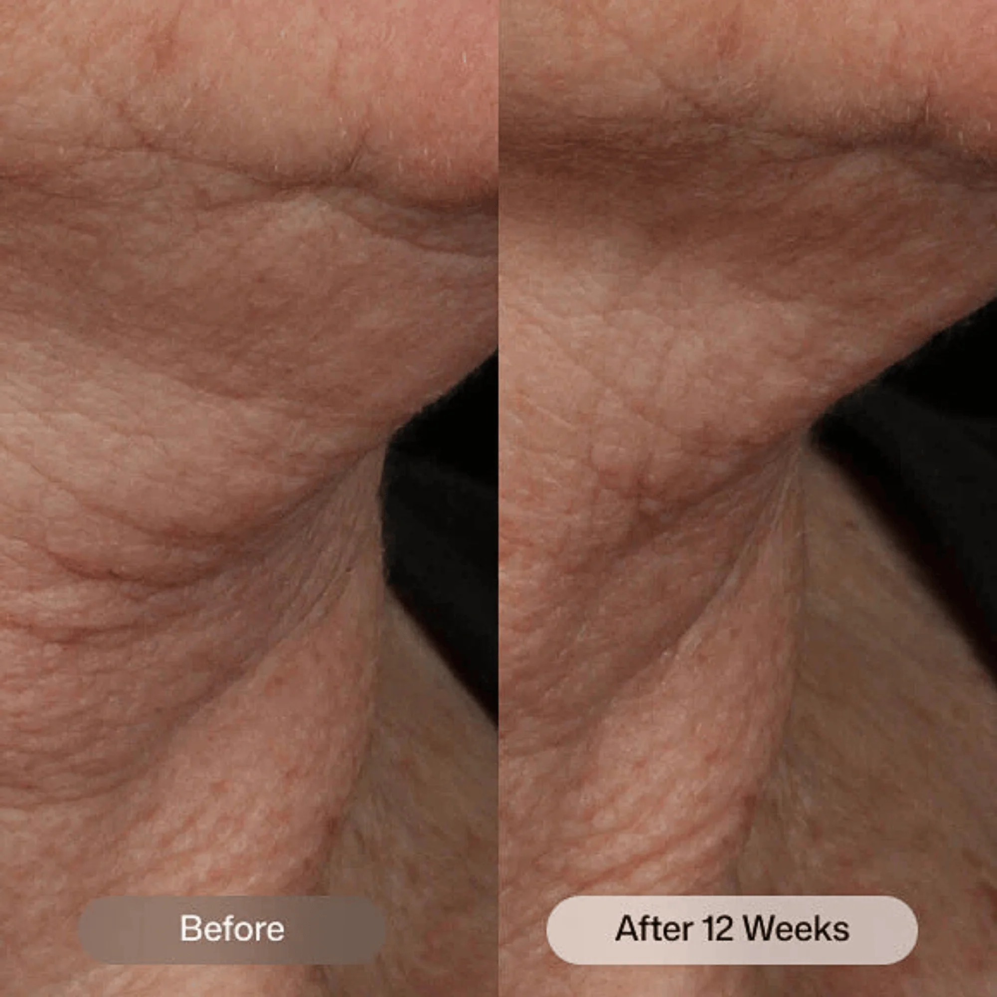 Revision Skincare Nectifirm Advanced - Image 6