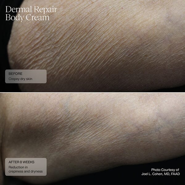 Sente Dermal Repair Body Cream - Image 3