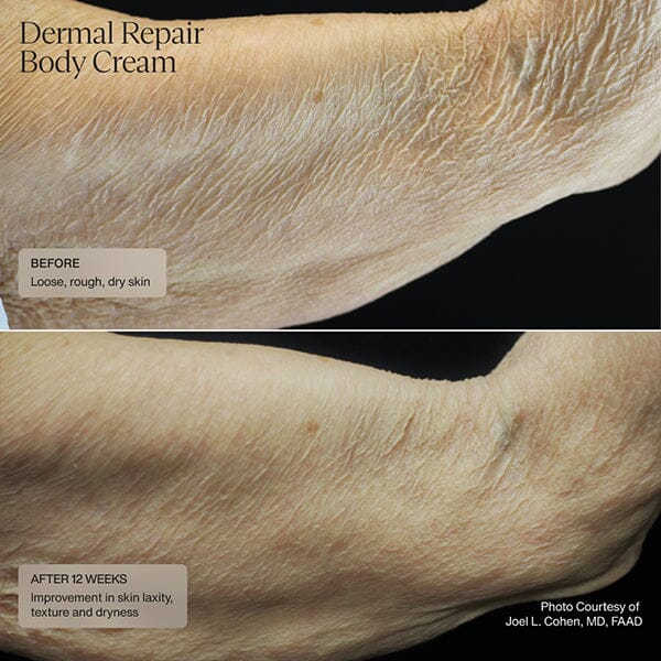 Sente Dermal Repair Body Cream - Image 4