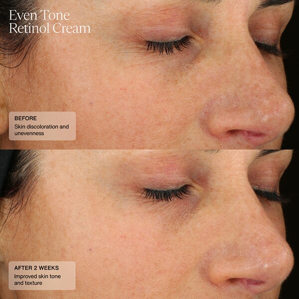 Sente Even Tone Retinol Cream - Image 4