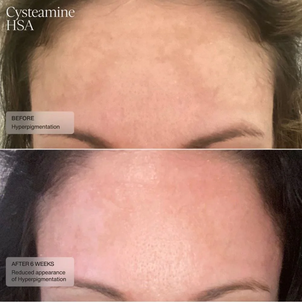 Sente Pigment & Tone Correcting Mask - Image 4