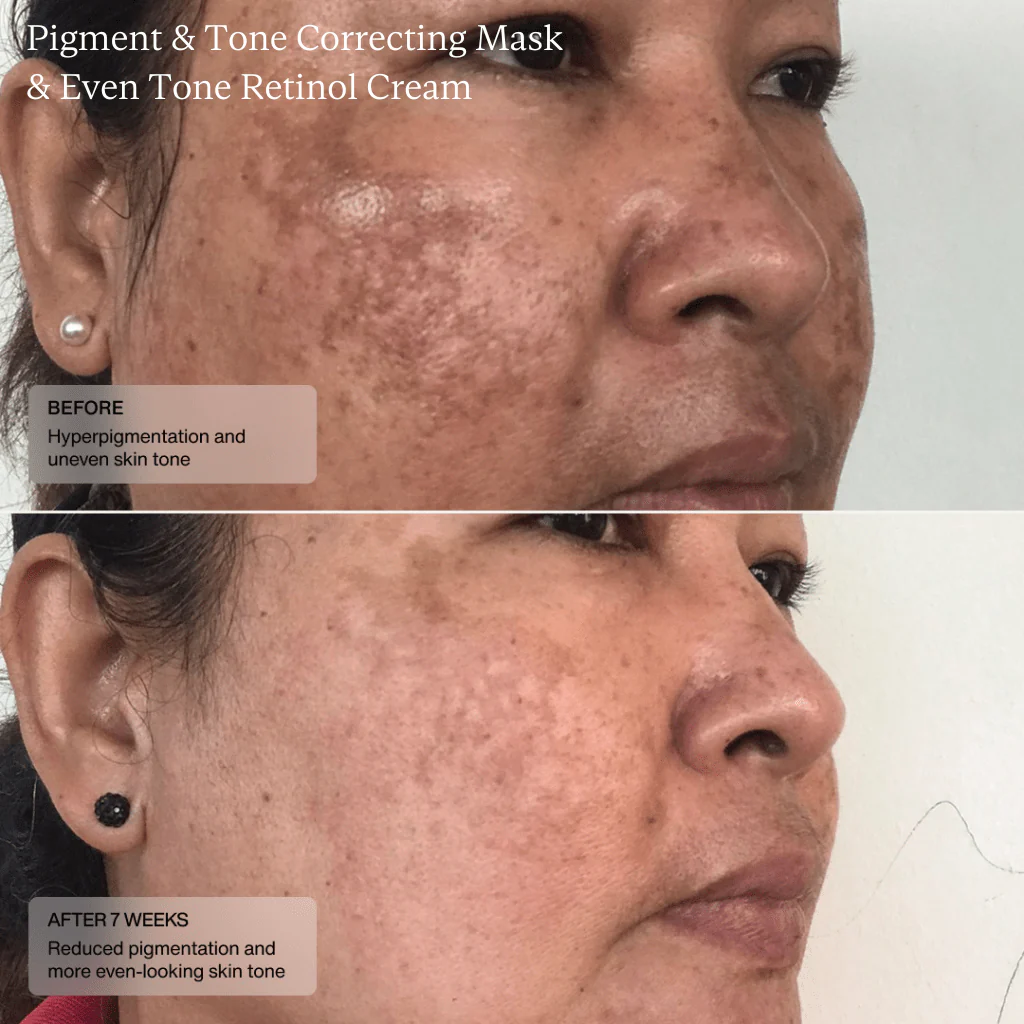 Sente Pigment & Tone Correcting Mask - Image 5