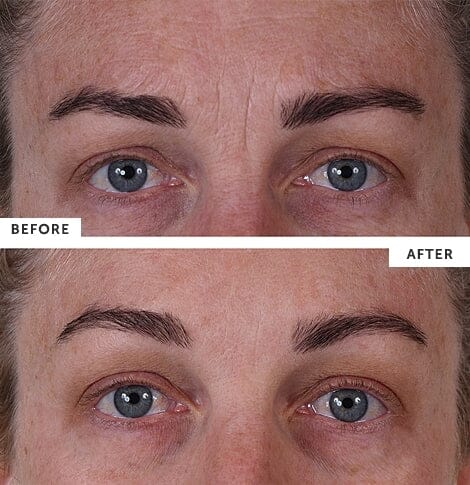 SilcSkin Full Face Set - Image 3