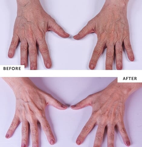SilcSkin Hand and Body Treatment - Image 4