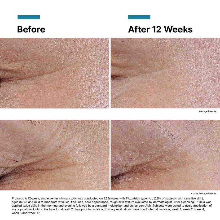 SkinCeuticals P-TIOX Wrinkle Modulating Peptide Serum - Image 9