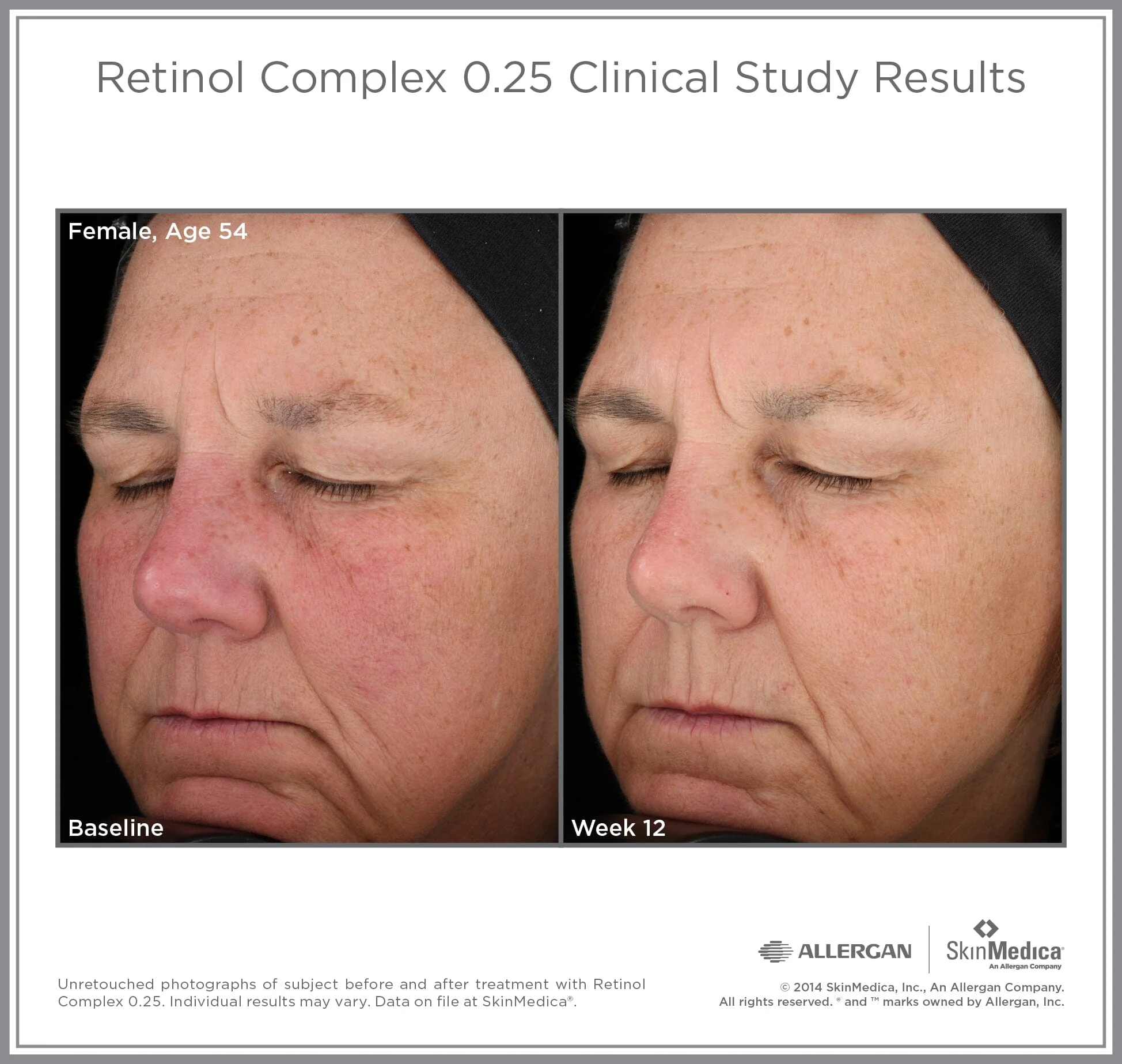 SkinMedica Retinol Complex 0.25 - Image 3