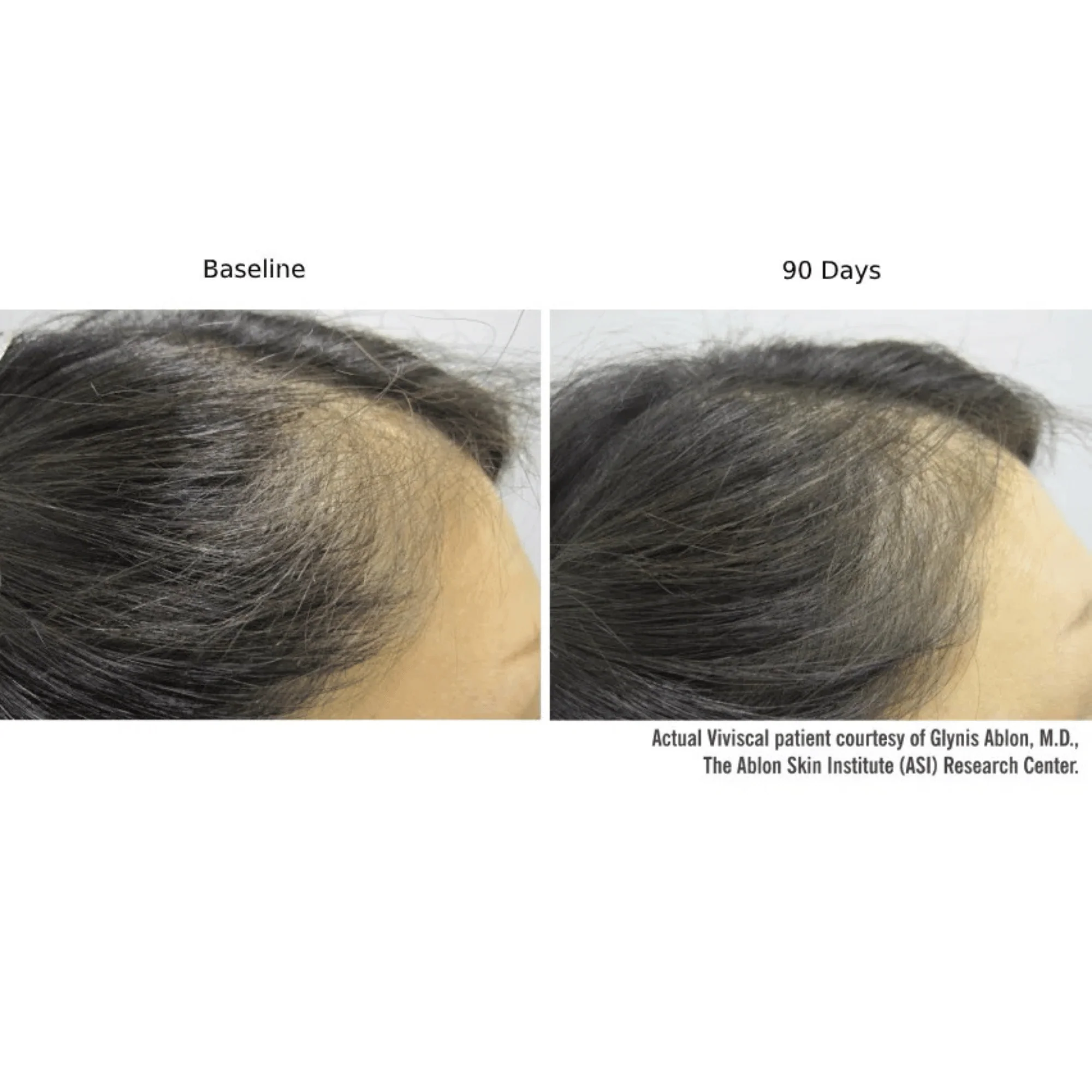 Viviscal PRO Hair Growth Supplement - 60 Tablets - Image 3